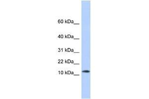 WB Suggested Anti-MAP1LC3A Antibody Titration:  0. (MAP1LC3A antibody  (N-Term))