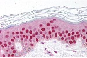 Human Skin (formalin-fixed, paraffin-embedded) stained with GDF9 antibody ABIN214650 at 10 ug/ml followed by biotinylated goat anti-rabbit IgG secondary antibody ABIN481713, alkaline phosphatase-streptavidin and chromogen. (GDF9 antibody  (AA 45-59))
