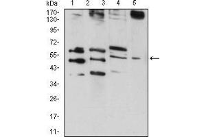 Western blot analysis using RAD52 mouse mAb against HepG2 (1), MCF-7 (2), MCF-7 (3), and C6 (4) cell lysate.