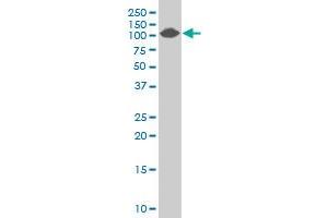COL4A3BP polyclonal antibody (A01), Lot # 060113JC01 Western Blot analysis of COL4A3BP expression in Jurkat . (COL4A3BP antibody  (AA 499-598))