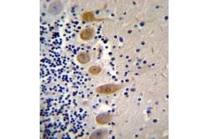 Immunohistochemistry (Paraffin-embedded Sections) (IHC (p)) image for anti-Macrophage Stimulating 1 (Hepatocyte Growth Factor-Like) (MST1) (AA 475-505), (C-Term) antibody (ABIN953271)