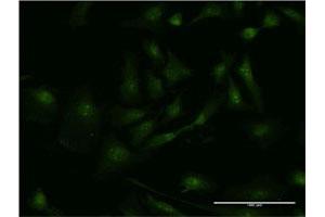 Immunofluorescence (IF) image for anti-SMAD, Mothers Against DPP Homolog 3 (SMAD3) (AA 1-110) antibody (ABIN561716)