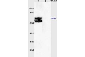 Lane 1: mouse embryo lysates Lane 2: mouse brain lysates probed with Anti PRKAG2/AMPK? (AMPK gamma 1/2/3 (AA 280-330) antibody)