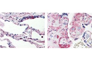 AP19004PU-N C5AR1 antibody staining of Formalin-Fixed, Paraffin-Embedded Human Lung (Left) and Human Placenta (Right) (C5AR1 antibody)