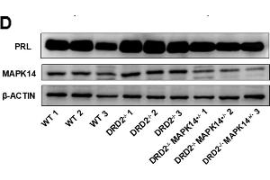 Effects of MAPK14 knockout on the development of prolactinoma in DRD2-/- mice.