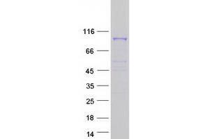 Validation with Western Blot (COPG2 Protein (Myc-DYKDDDDK Tag))