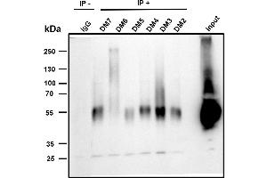 Immunoprecipitation (IP) image for anti-Tumor Necrosis Factor Receptor Superfamily, Member 17 (TNFRSF17) (AA 1-54) antibody (ABIN6961043)