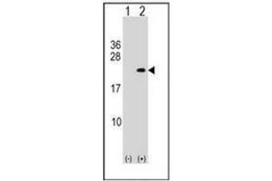 Western blot analysis of PLA2G12A (arrow) using PLA2G12A Antibody (Center) Cat. (PLA2G12A antibody  (Middle Region))