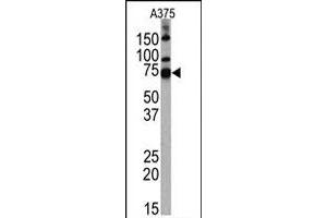 Western blot analysis of HDAC10 polyclonal antibody  in A-375 cell line lysates.