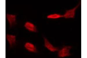 ABIN6274578 staining lOVO by IF/ICC. (alpha 1 Adrenergic Receptor antibody  (Internal Region))