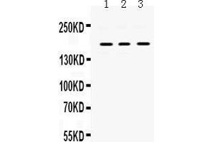 Western Blotting (WB) image for anti-Platelet Derived Growth Factor Receptor alpha (PDGFRA) (AA 968-1002), (C-Term) antibody (ABIN3043897) (PDGFRA antibody  (C-Term))