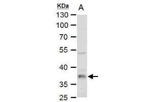 Western Blotting (WB) image for anti-Lactate Dehydrogenase B (LDHB) antibody (ABIN2855152)