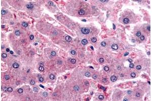 Human Liver (formalin-fixed, paraffin-embedded) stained with DPP9 antibody ABIN364226 at 20 ug/ml followed by biotinylated goat anti-rabbit IgG secondary antibody ABIN481713, alkaline phosphatase-streptavidin and chromogen. (DPP9 antibody  (N-Term))