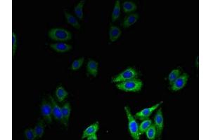 Immunofluorescent analysis of HepG2 cells using ABIN7145472 at dilution of 1:100 and Alexa Fluor 488-congugated AffiniPure Goat Anti-Rabbit IgG(H+L) (beta Defensin 1 antibody  (AA 33-68))