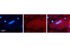 Rabbit Anti-HTRA1 Antibody Catalog Number: ARP63548_P050 Formalin Fixed Paraffin Embedded Tissue: Human heart Tissue Observed Staining: Cytoplasmic Primary Antibody Concentration: 1:100 Other Working Concentrations: 1:600 Secondary Antibody: Donkey anti-Rabbit-Cy3 Secondary Antibody Concentration: 1:200 Magnification: 20X Exposure Time: 0.