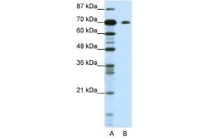 WB Suggested Anti-KLHL26  Antibody Titration: 1. (KLHL26 antibody  (C-Term))