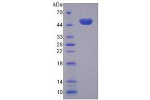 Image no. 1 for Surfactant Protein C (SFTPC) (AA 1-193) protein (His tag) (ABIN4988783)