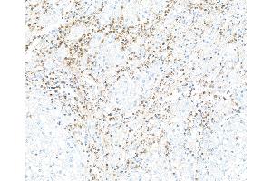 anti-CD226 (CD226) (AA 19-229) antibody