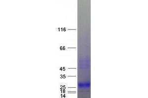 Validation with Western Blot (hCG Protein (Myc-DYKDDDDK Tag))