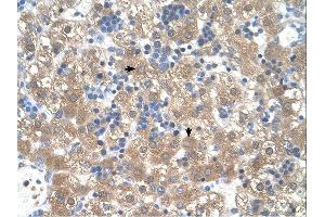 PEX3 antibody was used for immunohistochemistry at a concentration of 4-8 ug/ml. (PEX3 antibody  (N-Term))