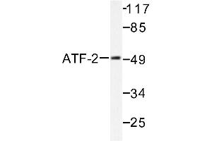 Image no. 1 for anti-Activating Transcription Factor 2 (ATF2) antibody (ABIN265321) (ATF2 antibody)