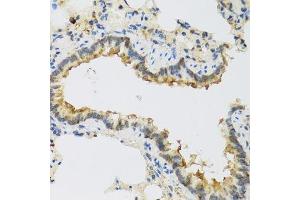 Immunohistochemistry of paraffin-embedded rat lung using FAM20A antibody.