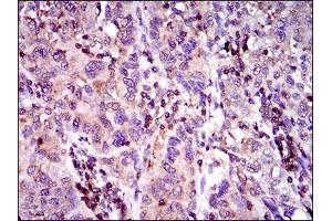 Immunohistochemistry (IHC) image for anti-ATP-Binding Cassette, Sub-Family C (CFTR/MRP), Member 4 (ABCC4) (AA 631-692) antibody (ABIN1724860)