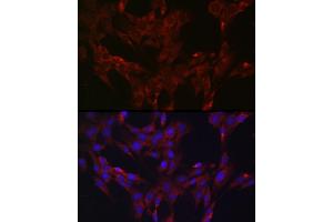 Immunofluorescence analysis of C6 cells using DUSP6 Rabbit pAb (ABIN3017520, ABIN3017521, ABIN3017522 and ABIN6220131) at dilution of 1:100 (40x lens). (DUSP6 antibody  (AA 1-170))