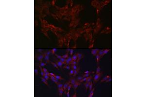 Immunofluorescence analysis of C6 cells using DUSP6 Rabbit pAb (ABIN3017520, ABIN3017521, ABIN3017522 and ABIN6220131) at dilution of 1:100 (40x lens). (DUSP6 antibody  (AA 1-170))
