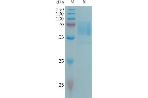 Human CD98 Protein, His Tag on SDS-PAGE under reducing condition.