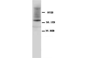 Western Blotting (WB) image for anti-Heat Shock 60kDa Protein 1 (Chaperonin) (HSPD1) antibody (ABIN1107605) (HSPD1 antibody)