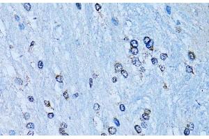 Immunohistochemistry of paraffin-embedded Rat brain using NFkB p100 / p52 Polyclonal Antibody at dilution of 1:100 (40x lens). (NFKB2 antibody)