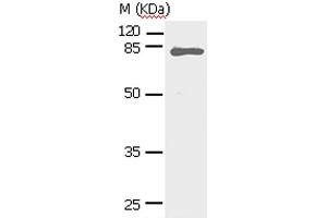 Western Blot analysis of Human fetal lung tissue using STAT5A Polyclonal Antibody at dilution of 1:450 (STAT5A antibody)