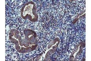 Image no. 1 for anti-Diphthamide Biosynthesis Protein 2 (DPH2) antibody (ABIN1497893) (DPH2 antibody)