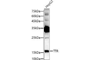 Western blot analysis of extracts of HepG2 cells, using TTR antibody (ABIN3021473, ABIN3021474, ABIN3021475 and ABIN6215107) at 1:1000 dilution. (TTR antibody  (AA 21-147))