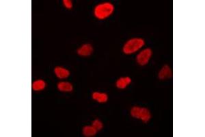 Immunofluorescent analysis of VWA5A staining in HeLa cells. (VWA5A antibody  (Center))