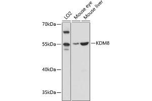 Western blot analysis of extracts of various cell lines, using KDM8 antibody (ABIN6128146, ABIN6142814, ABIN6142815 and ABIN6215293) at 1:3000 dilution. (JMJD5 antibody  (AA 147-416))