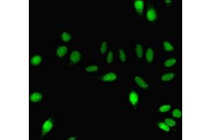Immunofluorescent analysis of A549 cells using ABIN7150825 at dilution of 1:100 and Alexa Fluor 488-congugated AffiniPure Goat Anti-Rabbit IgG(H+L) (Dynamin 1 antibody  (AA 2-245))