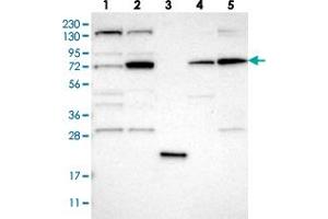 Western blot analysis of Lane 1: RT-4, Lane 2: U-251 MG, Lane 3: Human Plasma, Lane 4: Liver, Lane 5: Tonsil with DNAJC14 polyclonal antibody  at 1:250-1:500 dilution. (DNAJC14 antibody)