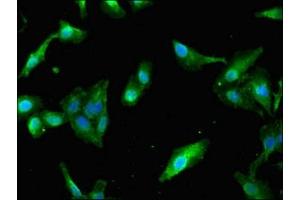 Immunofluorescent analysis of Hela cells using ABIN7163786 at dilution of 1:100 and Alexa Fluor 488-congugated AffiniPure Goat Anti-Rabbit IgG(H+L) (PAIP2 antibody  (AA 1-127))