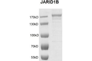 Recombinant JARID1B / KDM5B protein gel. (KDM5B Protein (full length) (DYKDDDDK Tag))