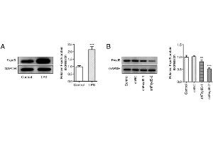 Fxyd5 silencing enhances cell viability and inhibits cell apoptosis and ECM degradation in ATDC5 cells. (FXYD5 antibody  (N-Term))