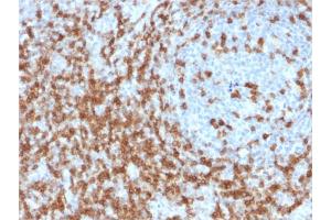 Formalin-fixed, paraffin-embedded human Tonsil stained with CD5 Mouse Monoclonal Antibody (CD5/2419). (CD5 antibody  (AA 269-366))