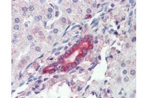IHC testing of FFPE human liver tissue with ROR1 antibody at 3ug/ml. (ROR1 antibody)