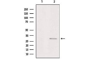 Western blot analysis of extracts from Hela, using ASAH3 Antibody. (ACER1 antibody  (Internal Region))