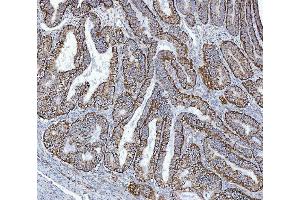 IHC analysis of GLUD1/2 using anti-GLUD1/2 antibody (ABIN7602000). (GLUD1 / GLUD2 (AA 54-553) antibody)
