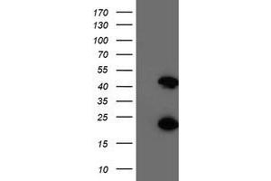 Western Blotting (WB) image for anti-Centromere Protein H (CENPH) antibody (ABIN1497473)