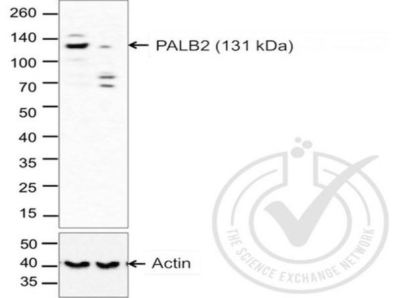 anti-Partner and Localizer of BRCA2 (PALB2) (AA 1101-1186) antibody