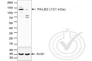 Western Blotting (WB) image for anti-Partner and Localizer of BRCA2 (PALB2) (AA 1101-1186) antibody (ABIN670536)