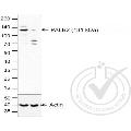 anti-Partner and Localizer of BRCA2 (PALB2) (AA 1101-1186) antibody